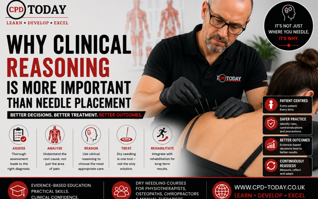 Why Clinical Reasoning Is More Important Than Needle Placement in Dry Needling