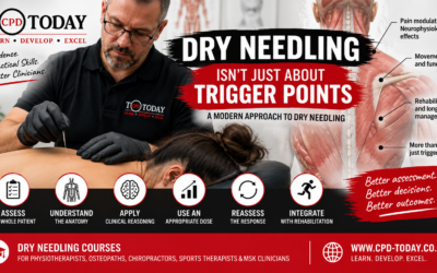 Dry Needling Isn’t Just About Trigger Points: Understanding Modern Dry Needling Practice
