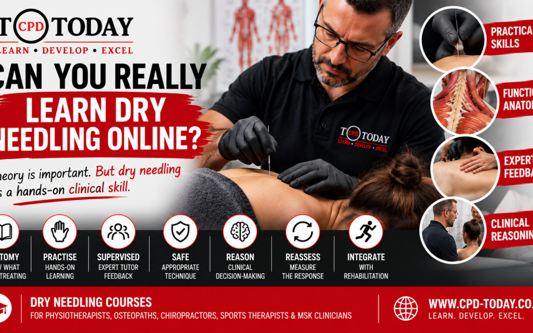 Why Hands-On Dry Needling Training Matters | Dry Needling Course UK